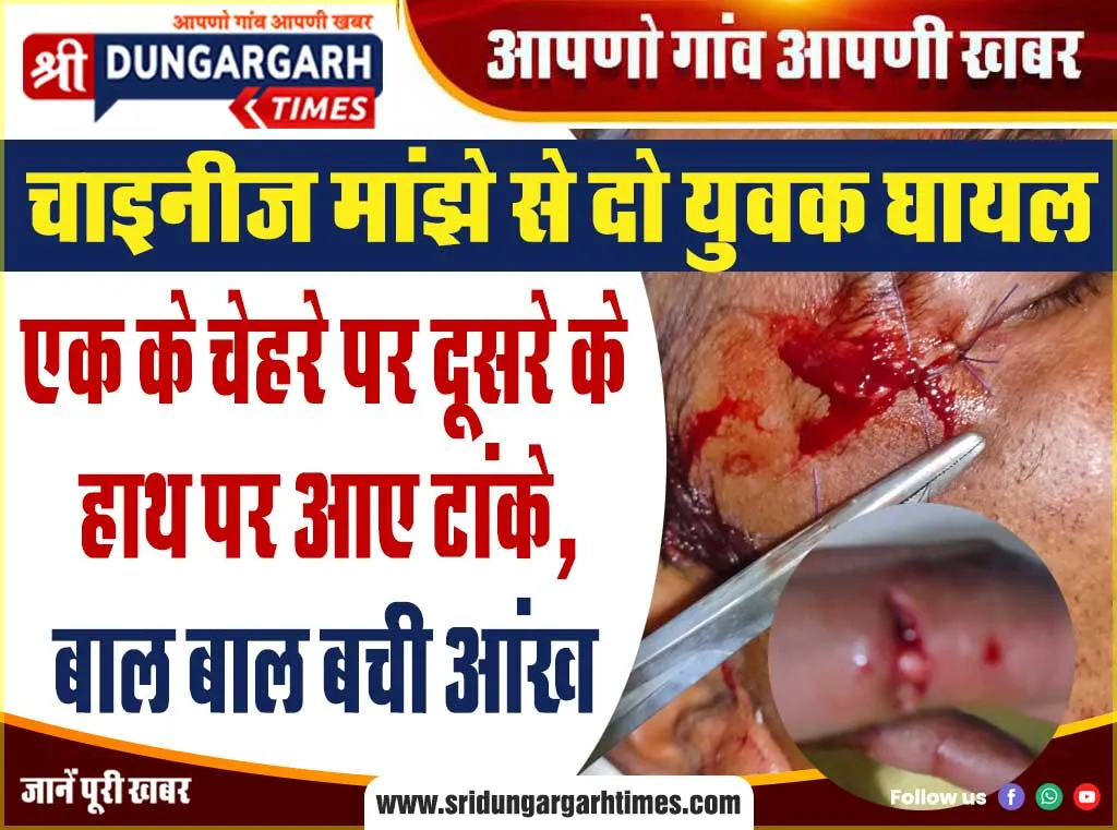 एक के चेहरे पर दूसरे के हाथ पर आए टांके, बाल बाल बची आंख